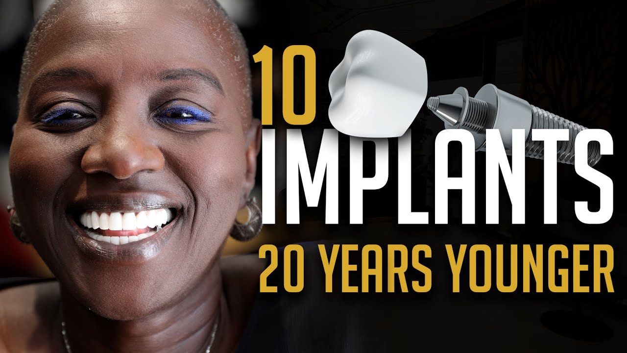 10 full mouth implants 20 years younger with dental tourism