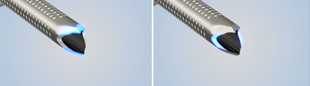 Dual-Beveled Raptor Tip