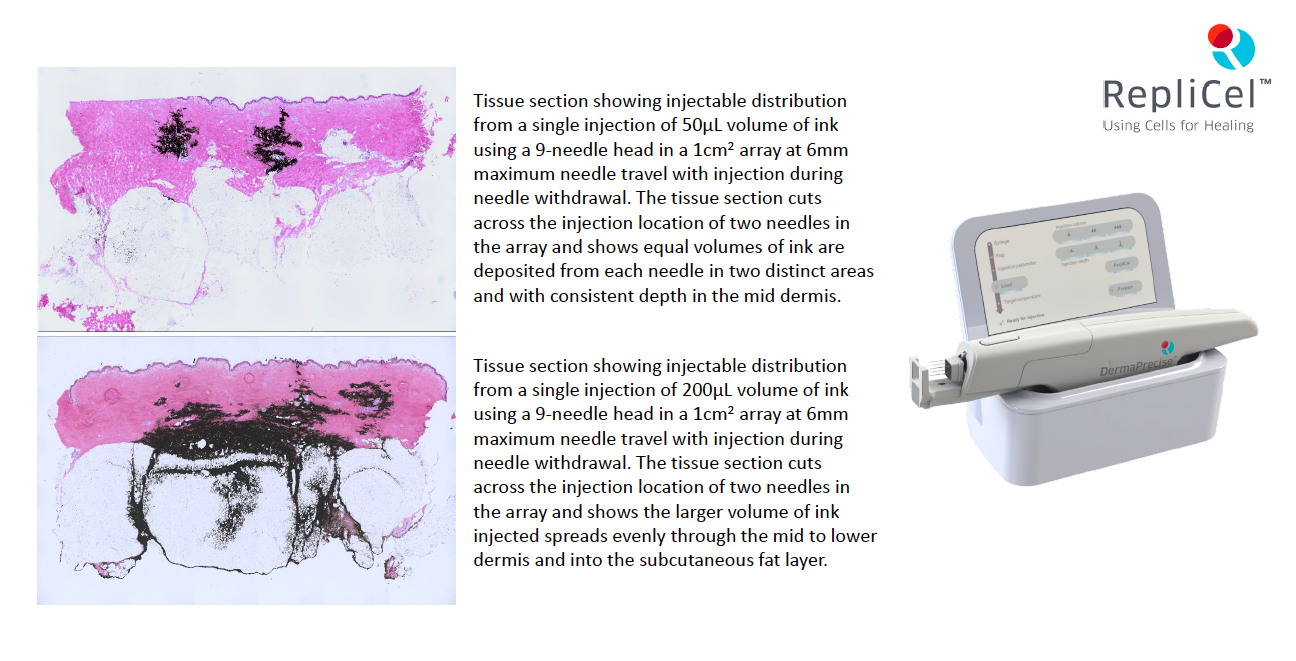 RepliCel Life Sciences, Inc., Tuesday, July 26, 2022, Press release picture