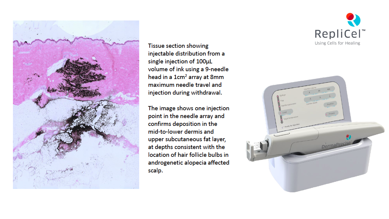 RepliCel Life Sciences, Inc., Tuesday, July 26, 2022, Press release picture