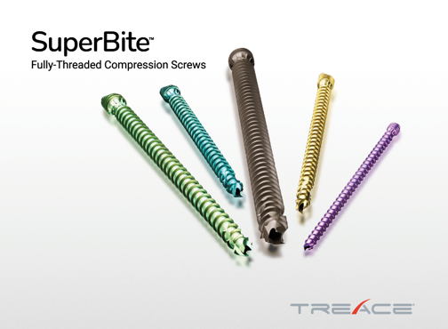 Treace Medical Concepts, Inc.