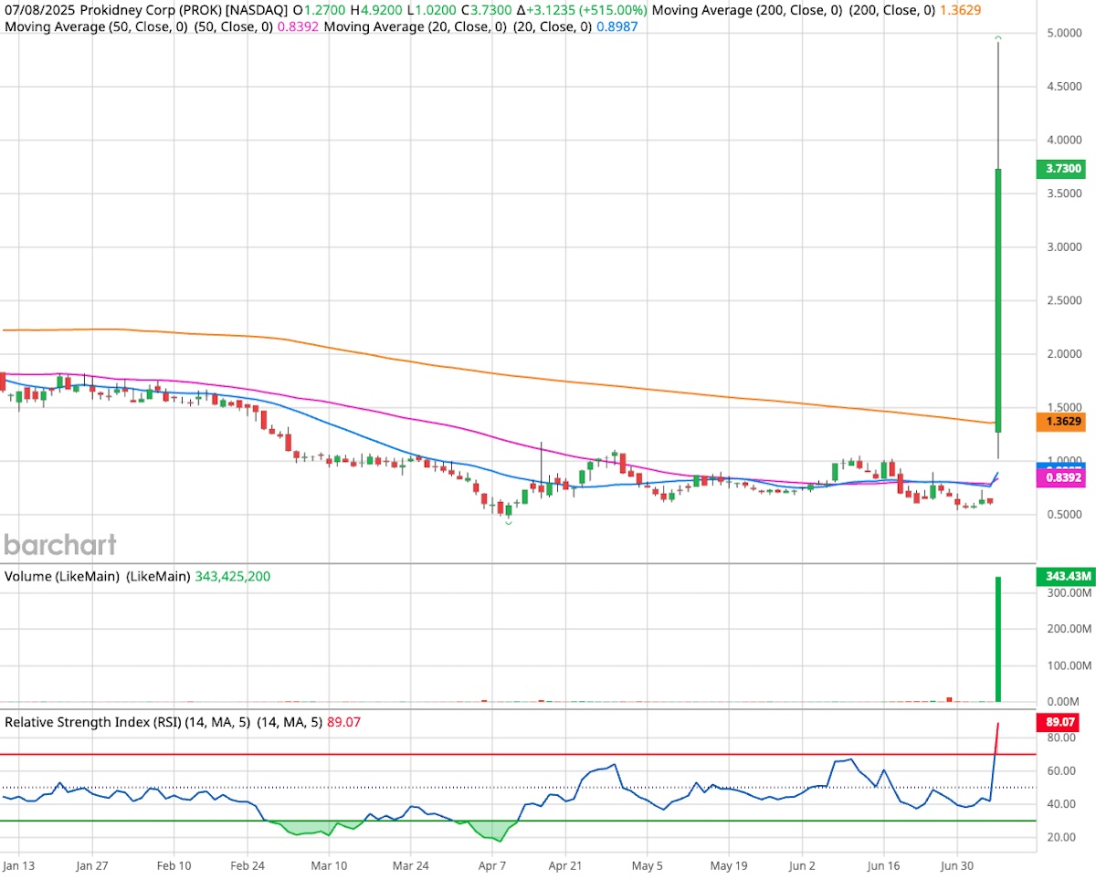 ProKidney Corp. candlestick stock chart on white background.