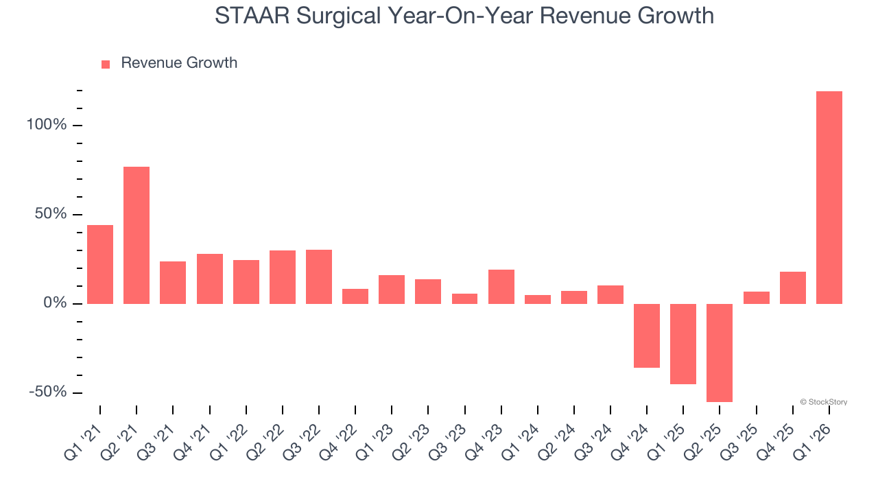 STAAR Surgical Year-On-Year Revenue Growth