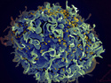 HIV Drug Approved